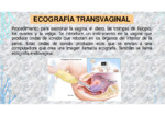 460 Ecografía Transvaginal.pdf